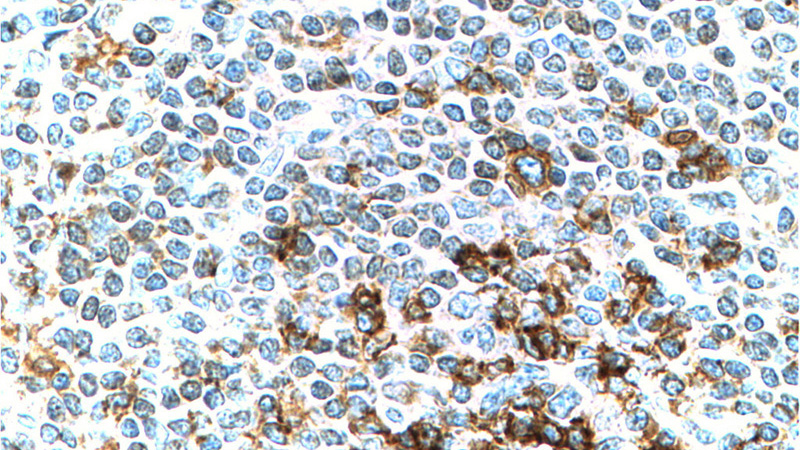 Immunohistochemistry of paraffin-embedded human tonsillitis tissue slide using Catalog No:107459(PD-1/CD279 Antibody) at dilution of 1:200 (under 40x lens). Heat mediated antigen retrieved with Tris-EDTA buffer, pH9.0