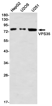 Western blot detection of VPS35 in HepG2,U2OS,U251 using VPS35 Rabbit mAb(1:1000 diluted)