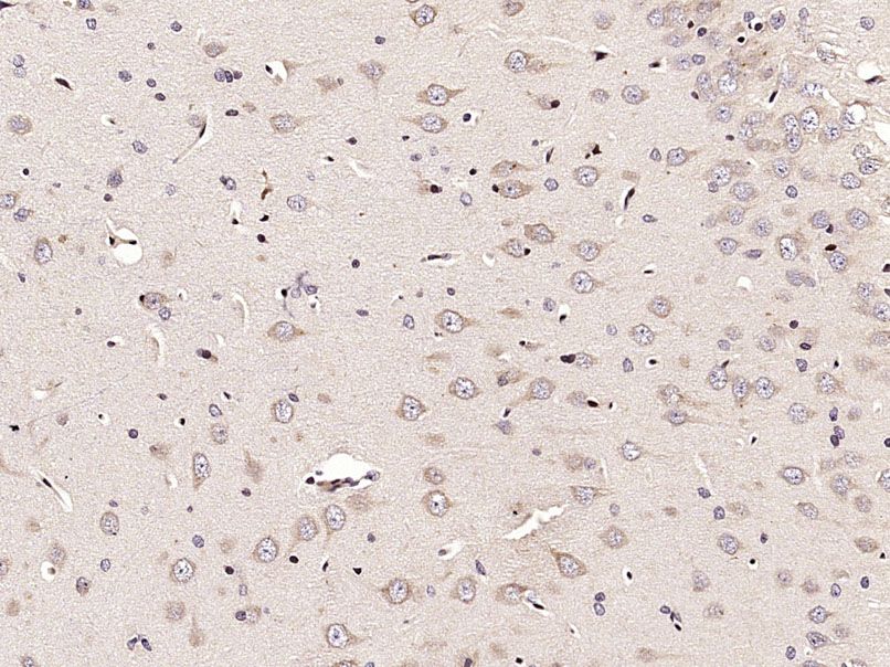 Fig2: Paraformaldehyde-fixed, paraffin embedded (Rat brain); Antigen retrieval by microwave in sodium citrate buffer (pH6.0) ; Block endogenous peroxidase by 3% hydrogen peroxide for 30 minutes; Blocking buffer (3% BSA) at RT for 30min; Antibody incubation with (ECE2) Polyclonal Antibody, Unconjugated at 1:400 overnight at 4℃, followed by conjugation to the secondary antibody (labeled with HRP)and DAB staining.