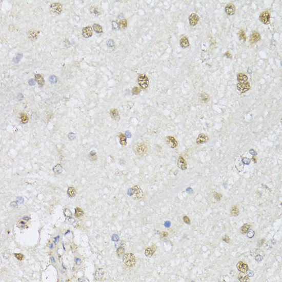 Immunohistochemistry - CMAS Polyclonal Antibody 