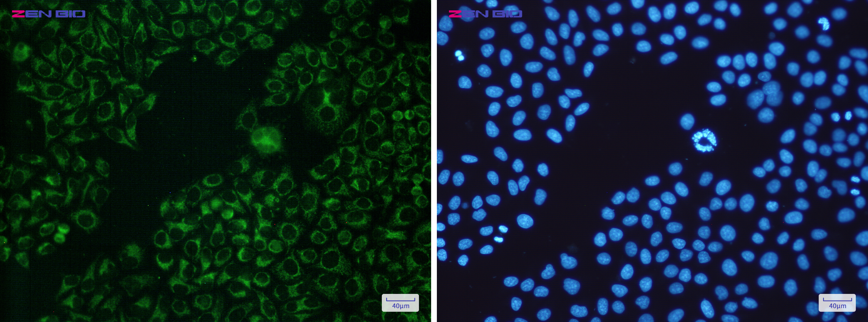 Immunocytochemistry of Bad(green) in Hela cells using Bad Rabbit pAb at dilution 1/50, and DAPI(blue)