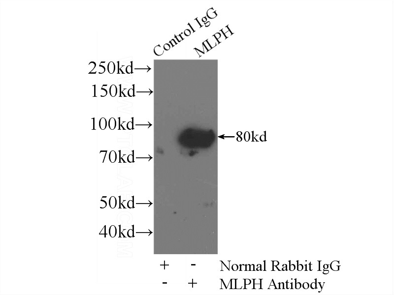 IP Result of anti-MLPH (IP:Catalog No:112651, 4ug; Detection:Catalog No:112651 1:600) with A375 cells lysate 3600ug.