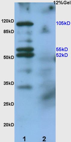 Fig1: Sample:; Human colon carcinoma lysates Lysate at 30 ug; Intestine (Mouse) Lysate at 30 ug; Primary: Anti- EphA2/Eph receptor A2 at 1/200 dilution; Secondary: HRP conjugated Goat-Anti-rabbit IgG (bs-0295G-HRP) at 1/3000 dilution; Predicted band size : 105kD; Observed band size : 105kD, 52/55kD