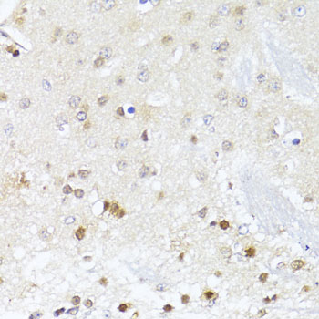 Immunohistochemistry - EGLN1/EGLN2 Polyclonal Antibody 