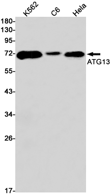 Western blot detection of ATG13 in K562,C6,Hela cell lysates using ATG13 Rabbit mAb(1:1000 diluted).Predicted band size:56kDa.Observed band size:72kDa.