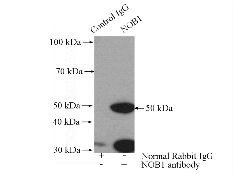 IP Result of anti-NOB1 (IP:Catalog No:113262, 4ug; Detection:Catalog No:113262 1:300) with HepG2 cells lysate 2400ug.