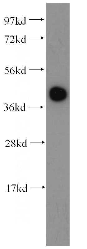 HeLa cells were subjected to SDS PAGE followed by western blot with Catalog No:112279(LAMR1,RPSA antibody) at dilution of 1:500