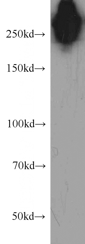 human brain tissue were subjected to SDS PAGE followed by western blot with Catalog No:107214(FN1 antibody) at dilution of 1:500