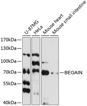 Western blot - BEGAIN Polyclonal Antibody 