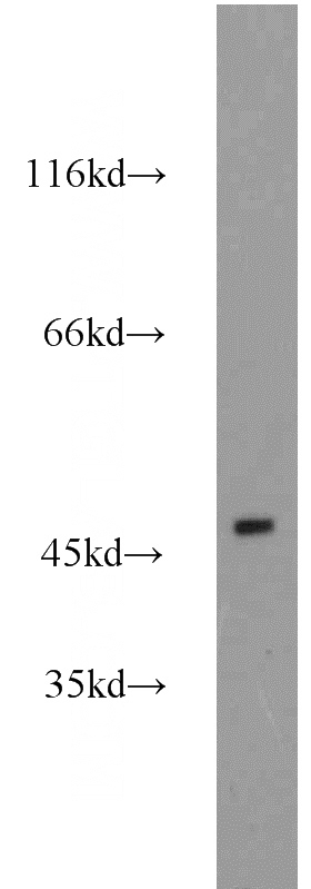 PC-13 cells were subjected to SDS PAGE followed by western blot with Catalog No:110479(ESRRB antibody) at dilution of 1:1000