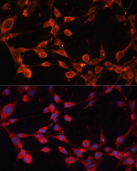 Immunofluorescence - SLC25A19 Polyclonal Antibody 