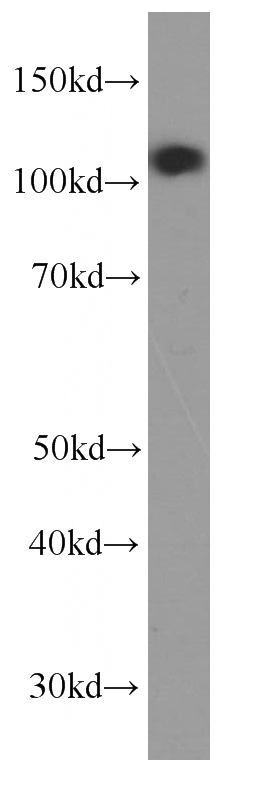 fetal human brain tissue were subjected to SDS PAGE followed by western blot with Catalog No:107441(CTNND1 Antibody) at dilution of 1:1000