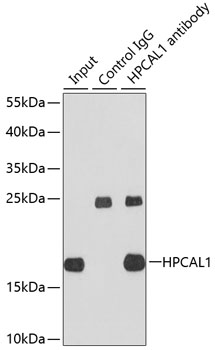 Immunoprecipitation - HPCAL1 Polyclonal Antibody 