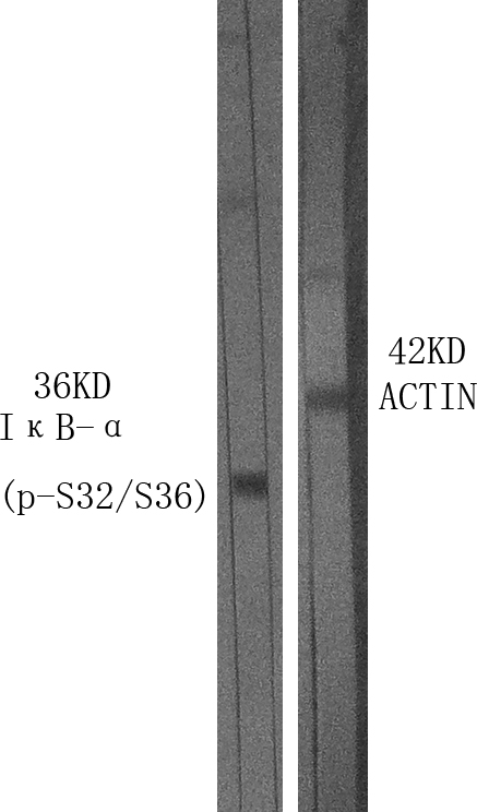 Western Blot analysis of various cells using Phospho-Iu03baB-u03b1 (S32/S36) Polyclonal Antibody