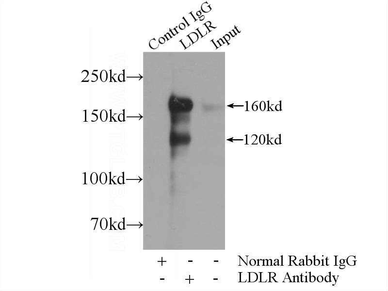 IP Result of anti-LDLR (IP:Catalog No:112188, 5ug; Detection:Catalog No:112188 1:500) with HeLa cells lysate 1200ug.
