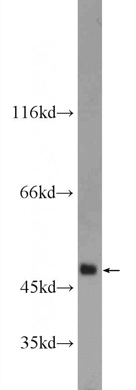 mouse brain tissue were subjected to SDS PAGE followed by western blot with Catalog No:112697(MMP12 Antibody) at dilution of 1:600