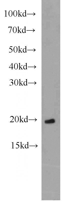 HeLa cells were subjected to SDS PAGE followed by western blot with Catalog No:108200(ARL3 antibody) at dilution of 1:1000