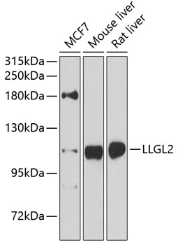 Western blot - LLGL2 Polyclonal Antibody 