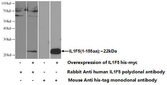 Transfected HEK-293 cells were subjected to SDS PAGE followed by western blot with Catalog No:111741(IL1F5 Antibody) at dilution of 1:1000