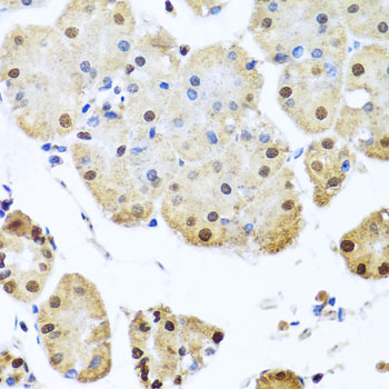 Immunohistochemistry - NUMA1 Polyclonal Antibody 
