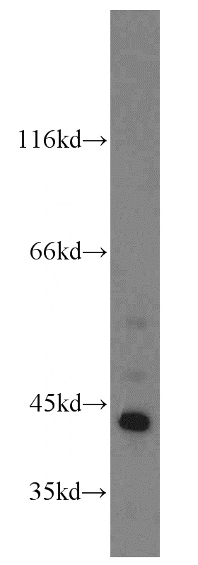 HeLa cells were subjected to SDS PAGE followed by western blot with Catalog No:110797(FUT10 antibody) at dilution of 1:500