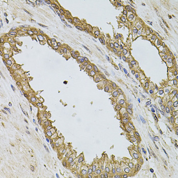 Immunohistochemistry - PIK3CA Polyclonal Antibody 