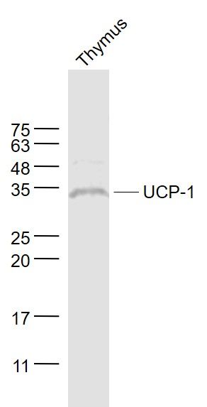 Fig2: Sample:; Thymus (Mouse) Lysate at 40 ug; Primary: Anti- UCP-1 at 1/1000 dilution; Secondary: IRDye800CW Goat Anti-Rabbit IgG at 1/20000 dilution; Predicted band size: 33 kD; Observed band size: 33 kD