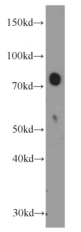 human plasma tissue were subjected to SDS PAGE followed by western blot with Catalog No:117340(TF Antibody) at dilution of 1:2000