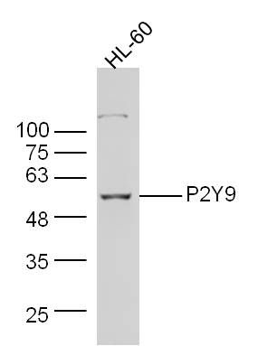 Fig4: Sample:; HL-60 Cell (Human) Lysate at 30 ug; Primary: Anti-P2Y9 at 1/300 dilution; Secondary: IRDye800CW Goat Anti-Rabbit IgG at 1/20000 dilution; Predicted band size: 55 kD; Observed band size: 55 kD