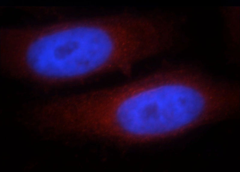 Immunofluorescent analysis of HepG2 cells, using CCDC153 antibody Catalog No:108965 at 1:25 dilution and Rhodamine-labeled goat anti-rabbit IgG (red). Blue pseudocolor = DAPI (fluorescent DNA dye).