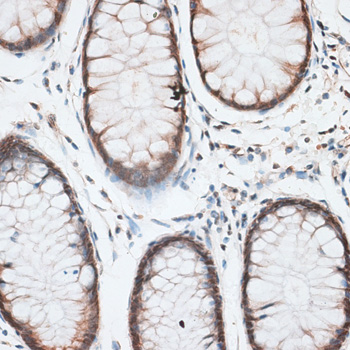 Immunohistochemistry - AQR Polyclonal Antibody 