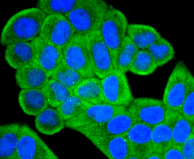 Fig2:; ICC staining of IGF2 in Hela cells (green). Formalin fixed cells were permeabilized with 0.1% Triton X-100 in TBS for 10 minutes at room temperature and blocked with 10% negative goat serum for 15 minutes at room temperature. Cells were probed with the primary antibody ( 1/50) for 1 hour at room temperature, washed with PBS. Alexa Fluor®488 conjugate-Goat anti-Rabbit IgG was used as the secondary antibody at 1/1,000 dilution. The nuclear counter stain is DAPI (blue).