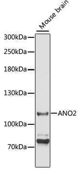 Western blot - ANO2 Polyclonal Antibody 