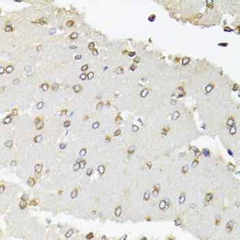 Immunohistochemistry - POLR2B Polyclonal Antibody 