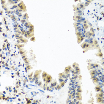 Immunohistochemistry - CALCB Polyclonal Antibody 