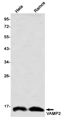 Western blot detection of VAMP2 in Hela,,Ramos using VAMP2 Rabbit mAb(1:1000 diluted)