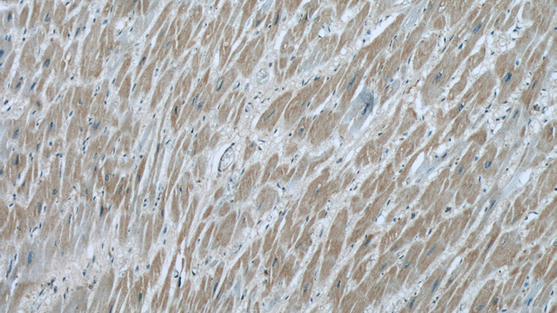 Immunohistochemical of paraffin-embedded human heart using Catalog No:110815(GAC-specific antibody) at dilution of 1:50 (under 10x lens)
