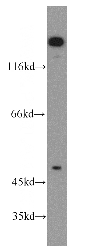 HeLa cells were subjected to SDS PAGE followed by western blot with Catalog No:110345(EPB41L2 antibody) at dilution of 1:800