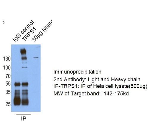 IP result of anti-TRPS1(Catalog No:116414 for IP and Detection).