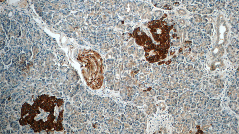 Immunohistochemistry of paraffin-embedded human pancreas tissue slide using Catalog No:114441(RAB3B Antibody) at dilution of 1:50 (under 10x lens)