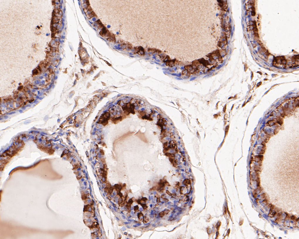 Fig2: Immunohistochemical analysis of paraffin-embedded rat seminal vesicle tissue using anti-SPATIAL antibody. The section was pre-treated using heat mediated antigen retrieval with Tris-EDTA buffer (pH 8.0-8.4) for 20 minutes.The tissues were blocked in 5% BSA for 30 minutes at room temperature, washed with ddH2O and PBS, and then probed with the primary antibody ( 1/50) for 30 minutes at room temperature. The detection was performed using an HRP conjugated compact polymer system. DAB was used as the chromogen. Tissues were counterstained with hematoxylin and mounted with DPX.