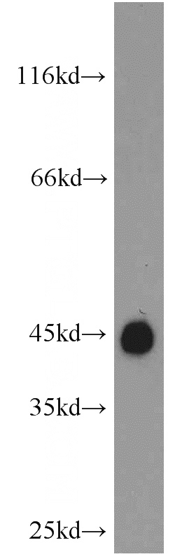 mouse brain tissue were subjected to SDS PAGE followed by western blot with Catalog No:110863(GAP43 antibody) at dilution of 1:1200