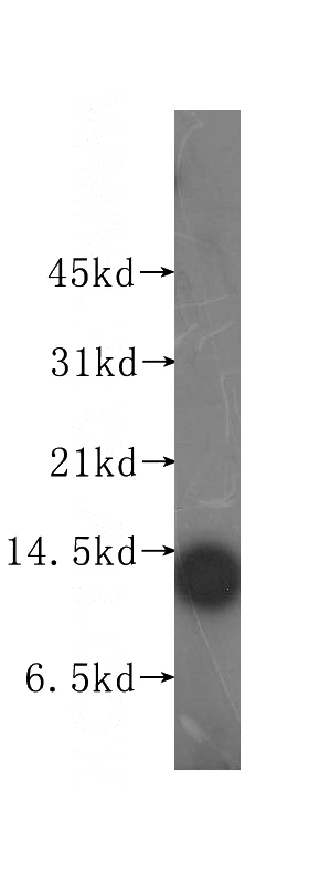 human heart tissue were subjected to SDS PAGE followed by western blot with Catalog No:112915(MYCBP antibody) at dilution of 1:500