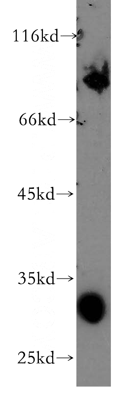A375 cells were subjected to SDS PAGE followed by western blot with Catalog No:115118(SEPT4 antibody) at dilution of 1:300