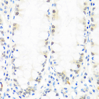 Immunohistochemistry - BRMS1 Polyclonal Antibody 