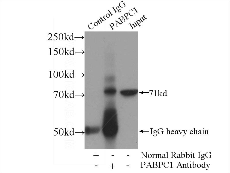 IP Result of anti-PABPC1,PABP (IP:Catalog No:113474, 4ug; Detection:Catalog No:113474 1:700) with mouse testis tissue lysate 4000ug.