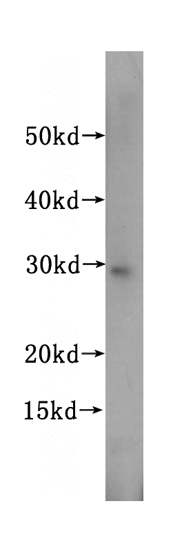 HL-60 cells were subjected to SDS PAGE followed by western blot with Catalog No:114979(SBDS antibody) at dilution of 1:500
