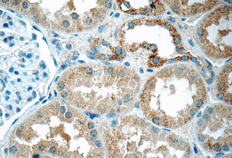 Immunohistochemistry of paraffin-embedded human kidney tissue slide using Catalog No:110038(DTX3 Antibody) at dilution of 1:50 (under 40x lens)