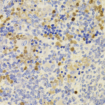 Immunohistochemistry - PRDM5 Polyclonal Antibody 