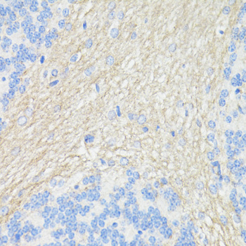 Immunohistochemistry - THY1 Polyclonal Antibody 